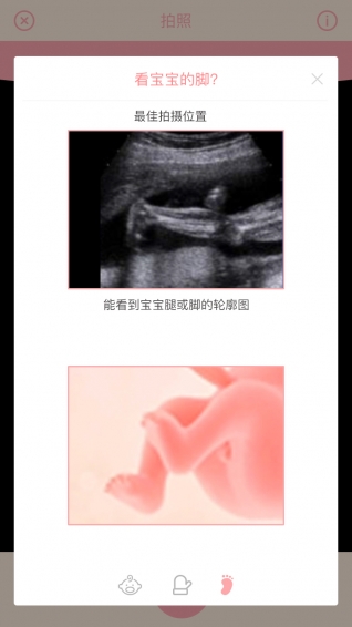 胎儿相机ios版截屏3